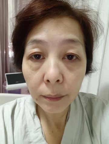 因为史湘云的脸上犯了杏斑癣,于是有了治疗药物蔷薇硝出场,但是被茉莉粉