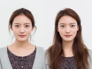 烟台女子花费6万元种植12颗牙两年后全拆体重骤降引发热议
