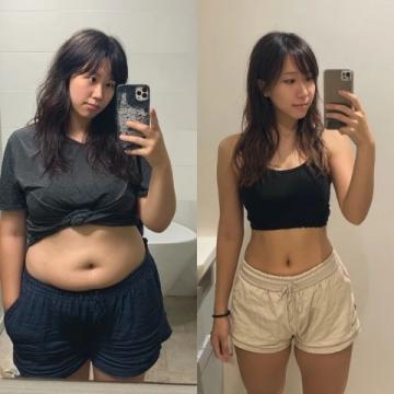 烟台女子花费6万元种植12颗牙两年后全拆体重骤降引发热议