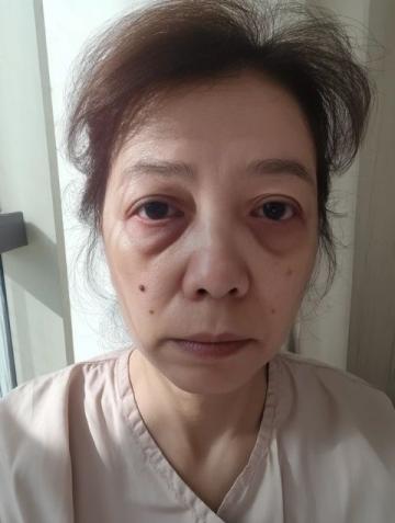 玉酱回国前,硬拉着山口去医院做了一次全面体检,回到山东老家,山口打视频电话