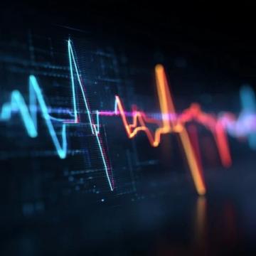心脏早搏:理解其成因与管理策略